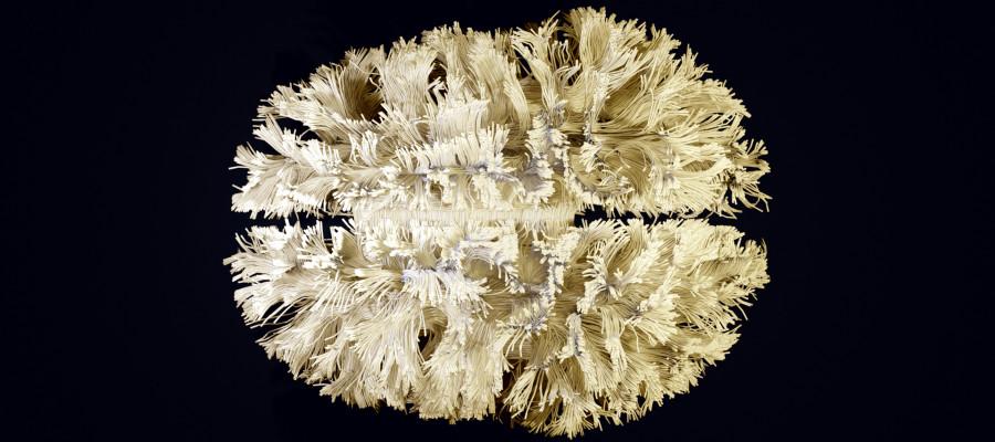 Lothian Birth Cohorts white matter connectome